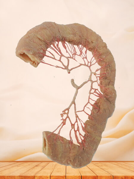 Ileum vascular arch