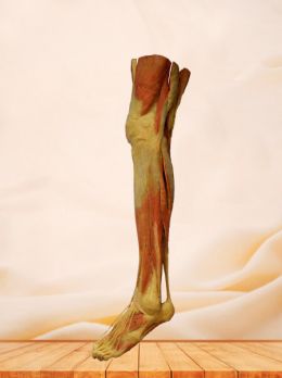 Superficial muscles of lower limb plastinated specimen