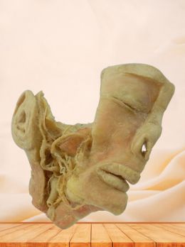 Trigeminal nerve plastinated specimen