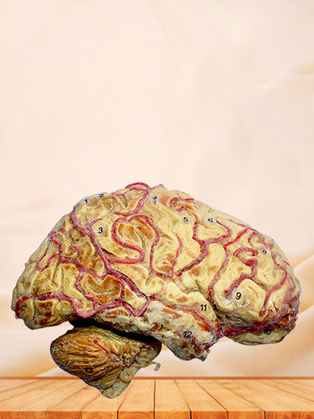 Cerebral hemisphere and brain stem