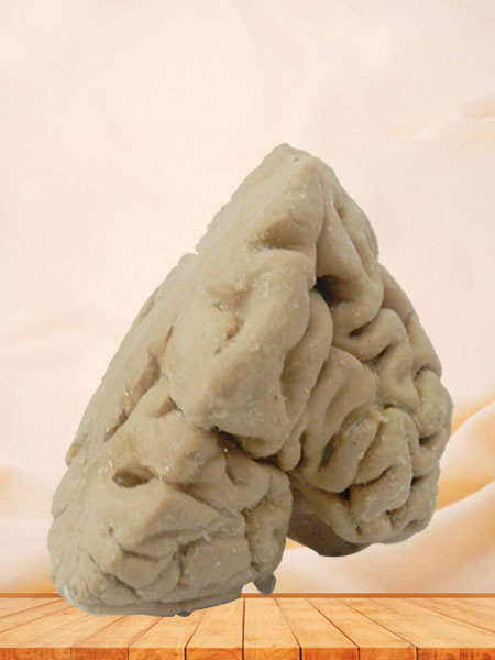 Coronal section of brain plastination