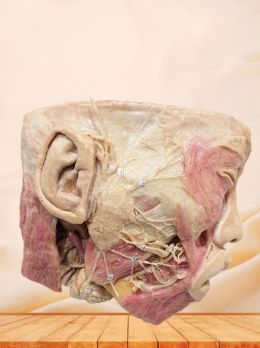 Facial nerve with its branches plastinated specimen