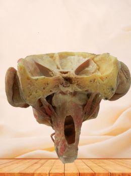 Posterior of pharyngeal muscles plastinated specimen