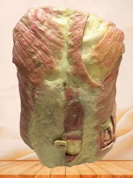 The front view of the chest wall plastinated specimen