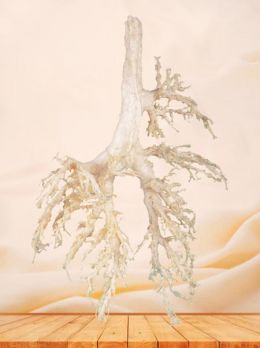 Bronchial tree of cow plastinated specimen