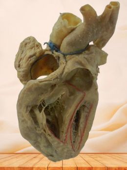 Conduction system of heart plastinated speciemen