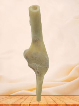 Coronal section of elbow joint plastinated specimen