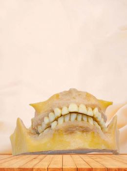 Permanent teeth plastinated specimen
