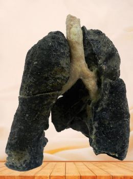 Smoker lung plastinated specimen