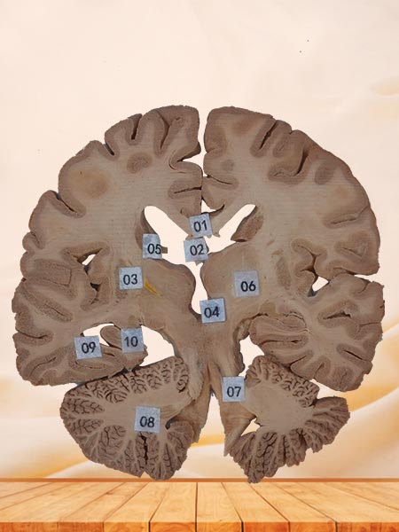coronal section of brain specimen plastination