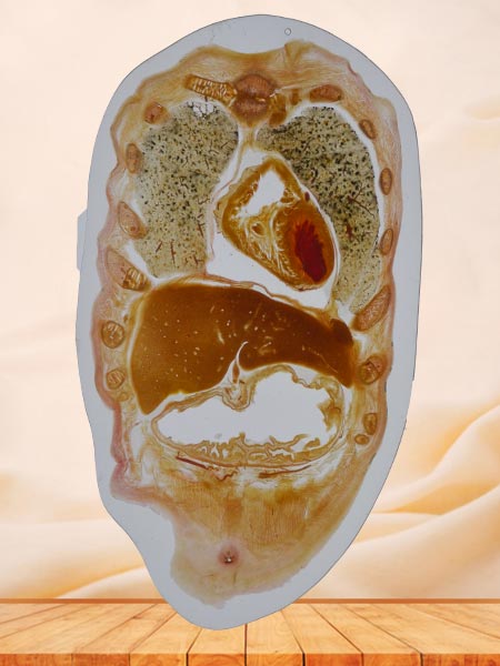 coronal section of whole body embedded specimen