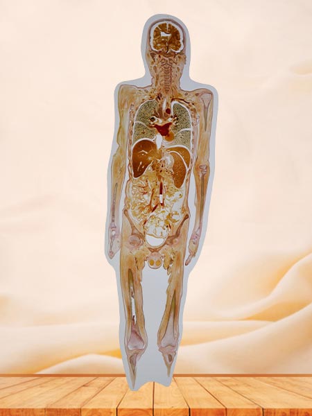 coronal section of whole body embedded specimen for sale