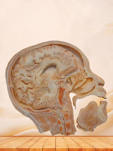 sagittal section of head