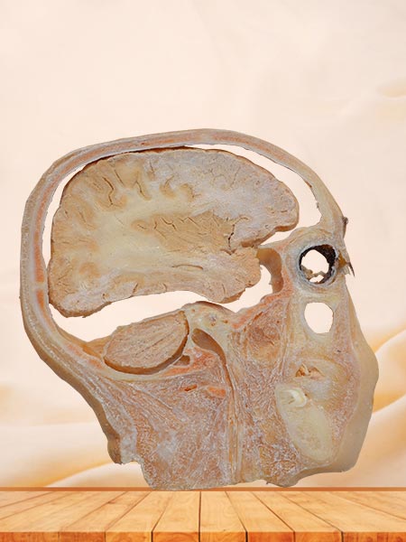 sagittal section of head plastination