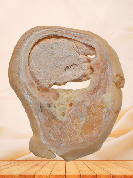 sagittal section of head specimen