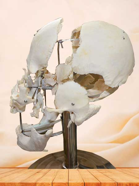 separated skull teaching plastinated specimen