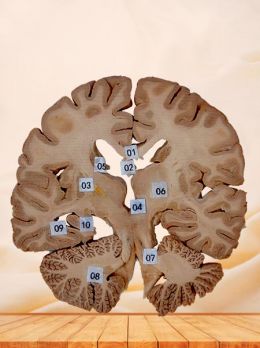 Coronal section of human brain plastinated specimen