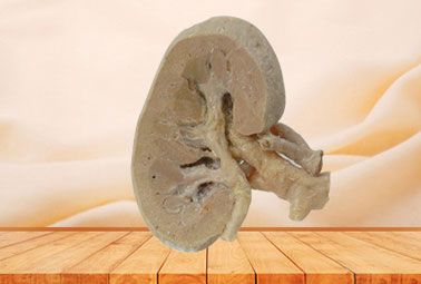 Coronal section of kidney plastinated specimen