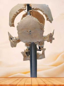 Separated human skull specimen with teeth