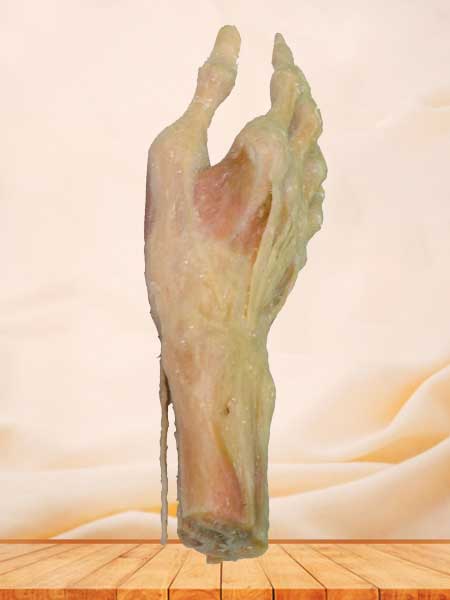 Superficial muscles of hand plastination