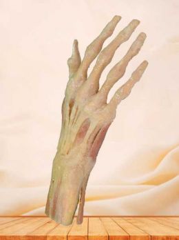 Superficial muscles of hand plastinated specimen