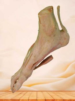 Superficial muscle of human foot plastinated specimen