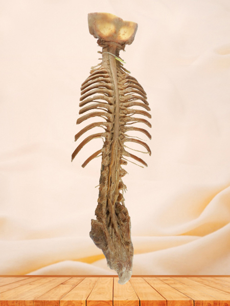 Spinal cord with nerves in vertebral column