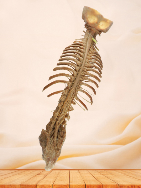 Spinal cord with nerves in vertebral column plastination