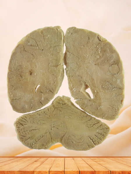coronal section of human brain for sale