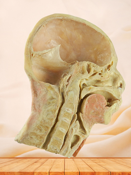 head and neck sagittal section plastination