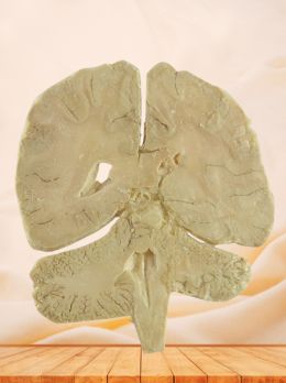 Coronal section of brain plastination specimen with 15 parts