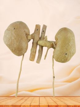 Double kidney plastinated specimen