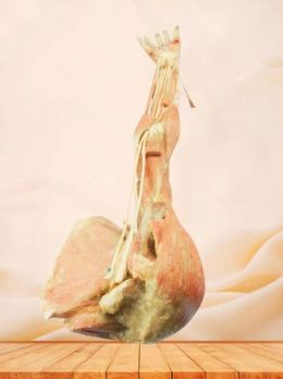 Deep arteries  of upper limb plastinated specimen