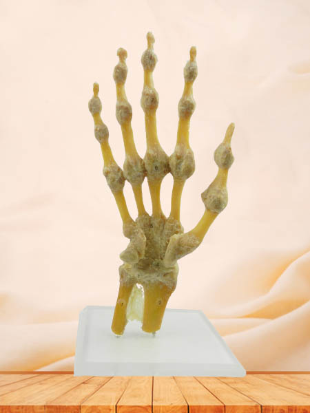 hand joint medical specimen