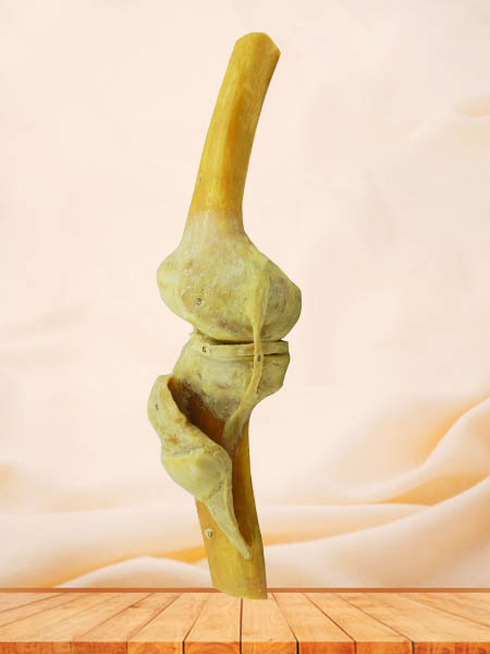 human knee joint specimen