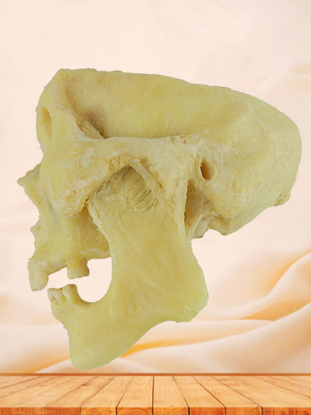 temporal-mandibular joint specimen