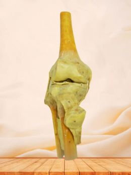 Human knee joint anatomy specimen