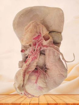 Liver stomach pancreas and duodenum plastinated specimen