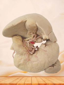 Liver stomach pancreas spleen and duodenum plastinated specimen
