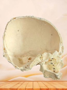 Lateral wall of nasal cavity specimen(sagittal section of skull)