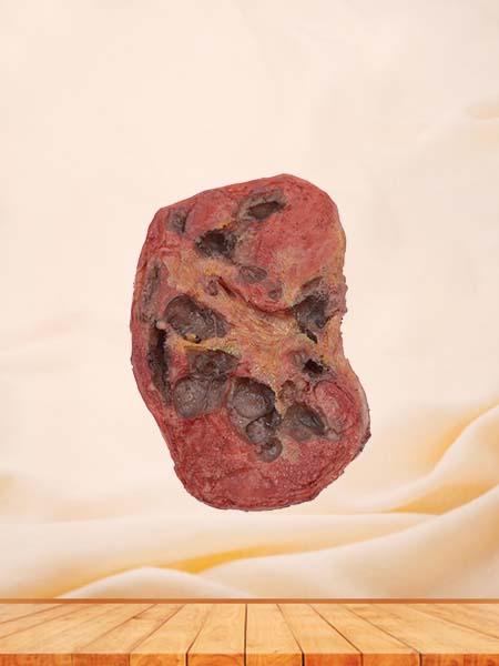 Soft Simulated Male Testis Anatomy Model