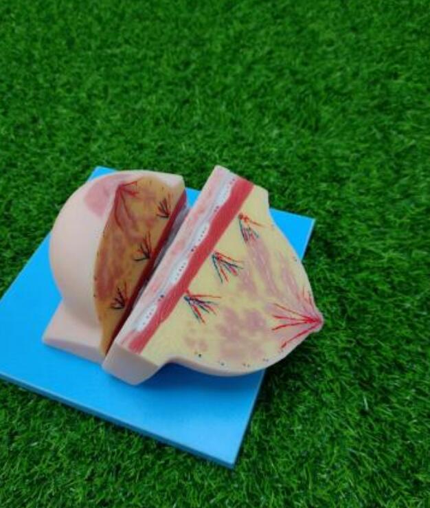 Quiescent Breast Soft Silicone Anatomy Model For Medical Education