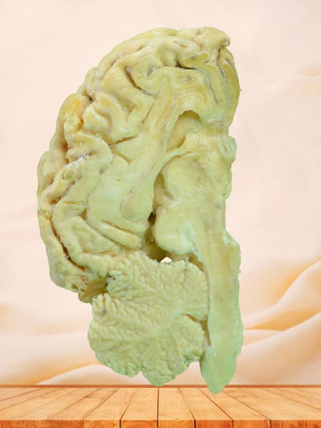 Brain hemisphere of sheep plastinated specimen