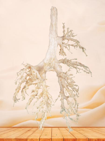 Bronchial tree of cow plastinated specimen