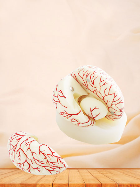 Cerebral Artery Soft Silicone Anatomy Model