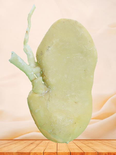 Coronal section of pig kidney plastinated specimen