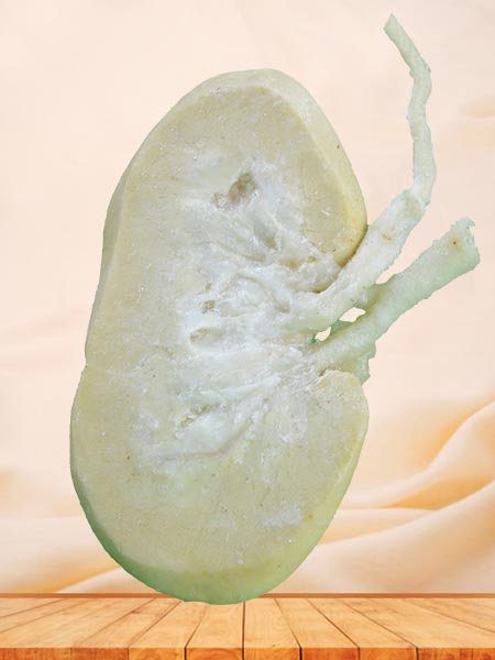 Coronal section of pig kidney plastinated specimen