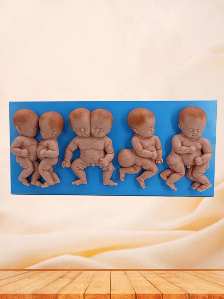 Deformed Fetus Simulation Model