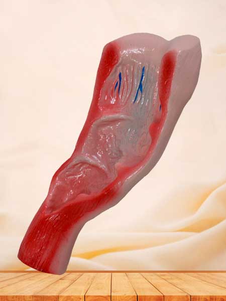 Human rectum cavity model