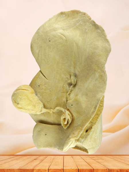 Liver of cattle medical specimen plastination